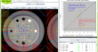 CBCT QA, CT-scanner QA, IGRT QA, linac QA QUALIMAGIQ module for an advanced and fully automatic image QA of a linac's CBCT imager or of a CT-scanner