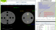 QUALIMAGIQ module for a fully automatic analysis of electronic density calibration of CBCT or CT images