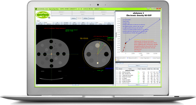 QUALIMAGIQ module for a fully automatic analysis of electronic density calibration of CBCT or CT images